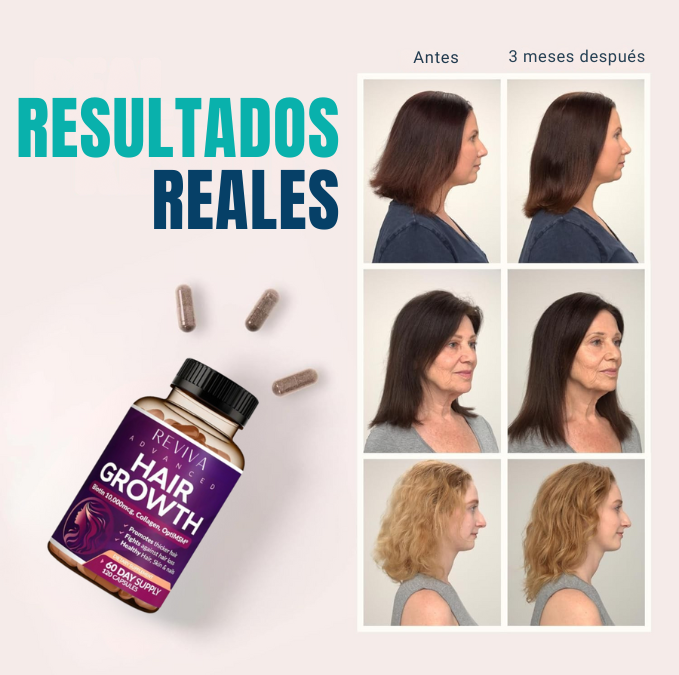 Fórmula capilar avanzada Reviva